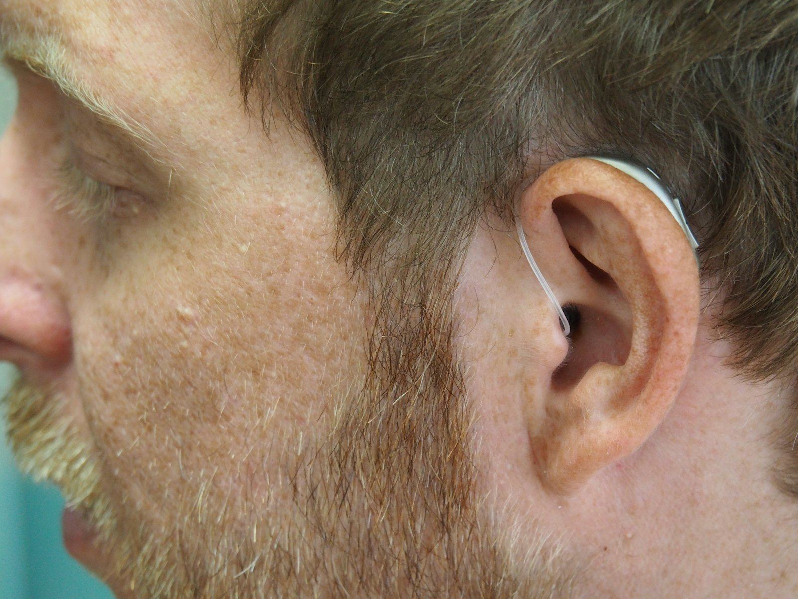 Side profile close-up of a man wearing a hearing aid behind his ear.